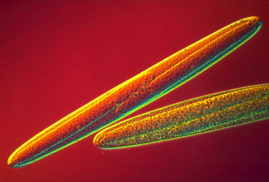 Самую большую из известных бактерий можно увидеть невооружённым глазом