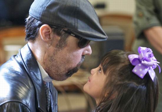 Человек без лица, наконец, может поцеловать свою дочь