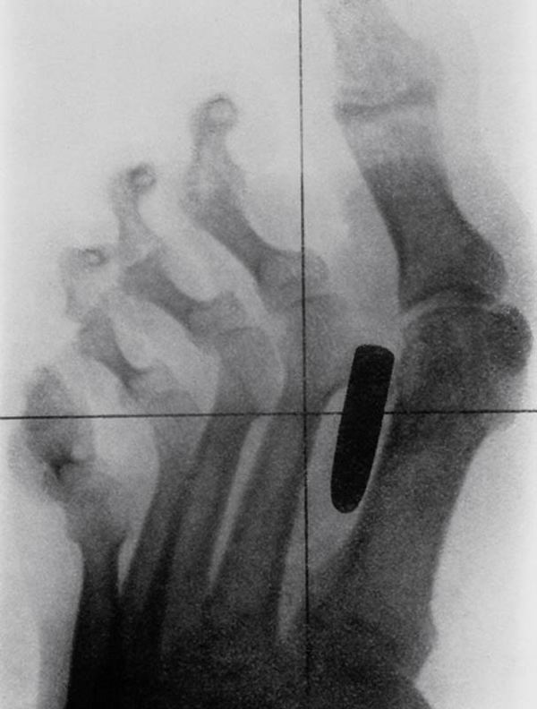 Самые странные рентгеновские снимки