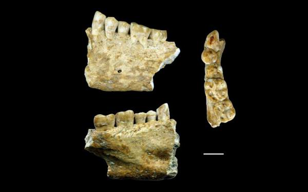 Найден древний зуб с древнейшей пломбой