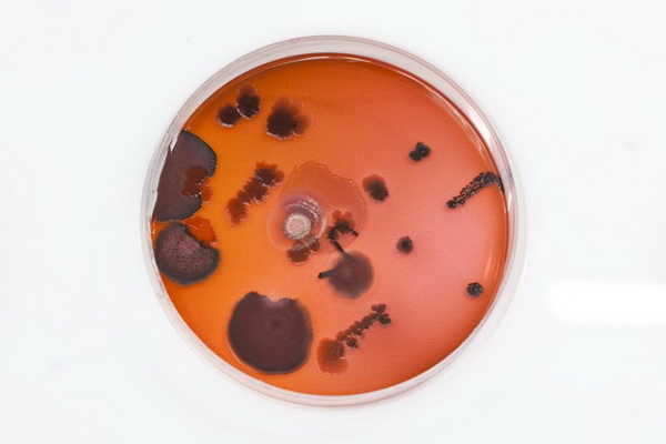 Так выглядят бактерии, живущие на деньгах