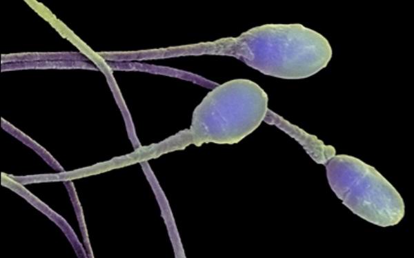 Сексуальные "пловцы": 7 фактов о сперматозоидах