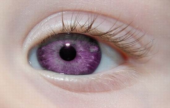Самый редкий цвет глаз в мире!