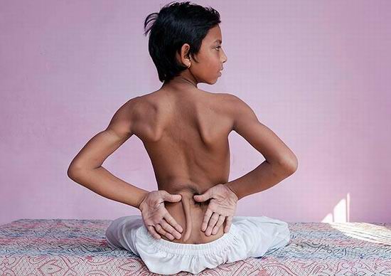 В Индии обожествили мальчика с хвостом